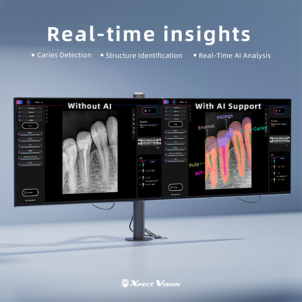 Sensor intraoral con cable xvd2530 imagen digital xpectvision