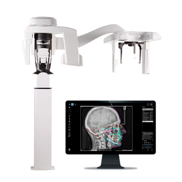 Scan ceph para cs 8200 3d radiologia extraoral carestream