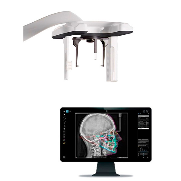 Scan ceph para cs 8200 3d radiologia extraoral carestream