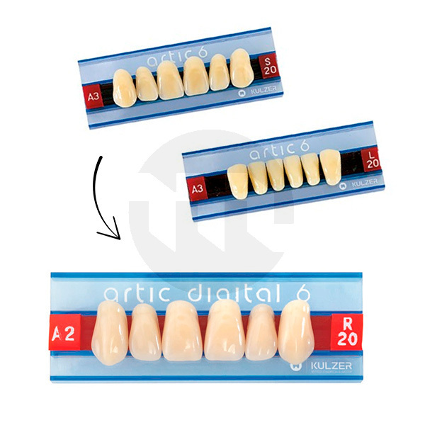 Dentes artic digital anteriores superiores dentes acrilicos kulzer