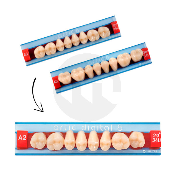 Dentes artic digital posteriores inferiores dentes acrilicos kulzer